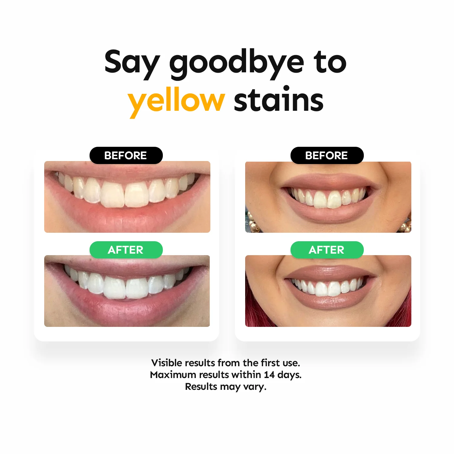 Strip Together Bundle - Image 3